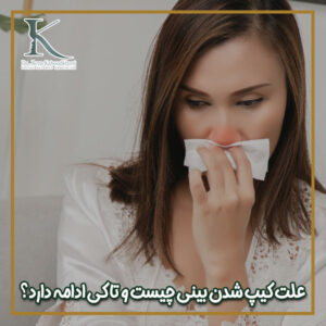 گرفتگی بینی