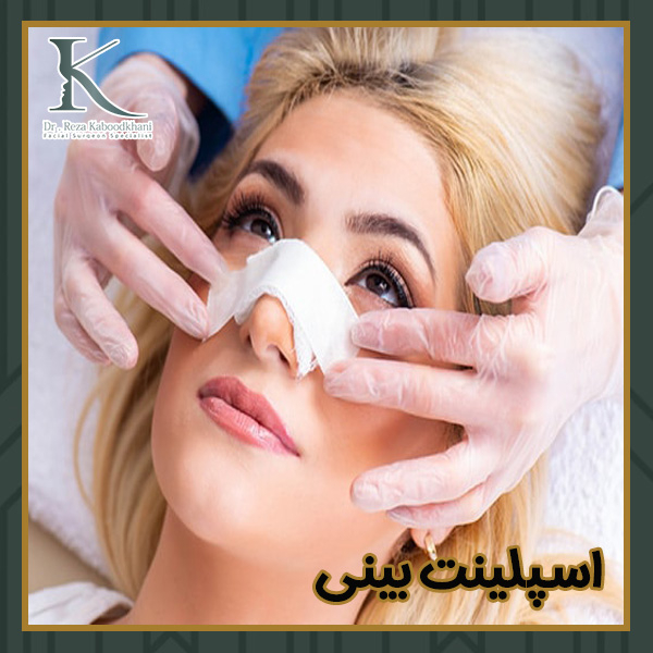 اسپلینت بینی - https://drkaboodkhani.com/