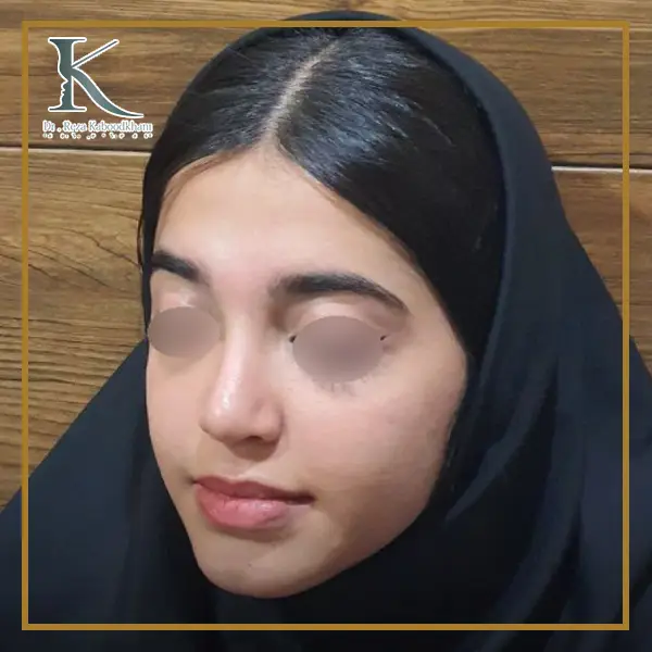 عکس بینی نیمه فانتزی و طبیعی https://drkaboodkhani.com/