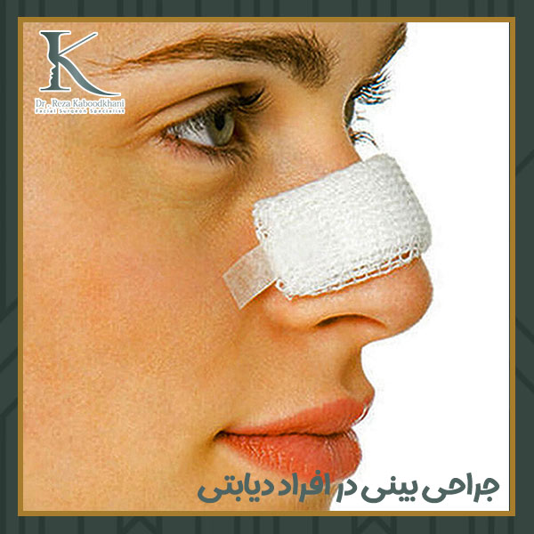 جراحی بینی در افراد دیابتی