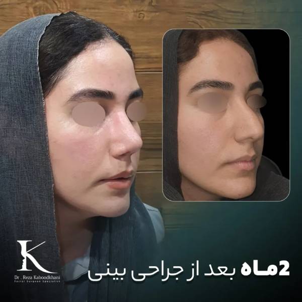 عکس عمل بینی